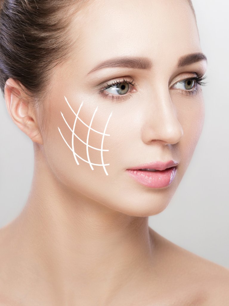 Rejuvenecimiento Facial