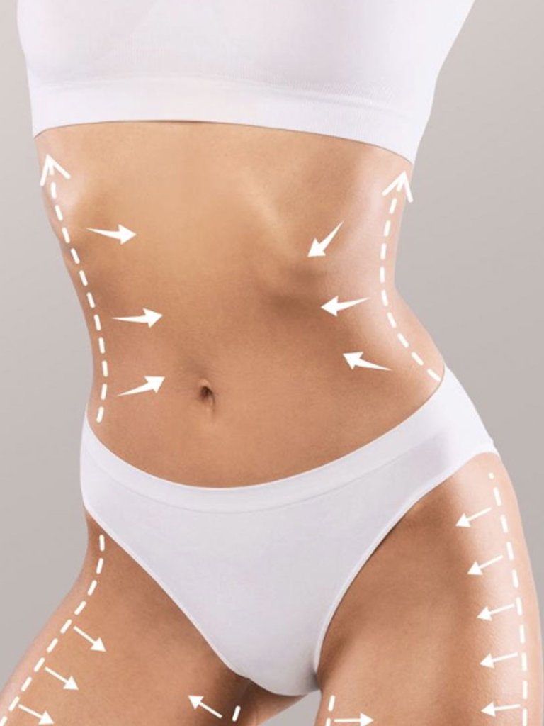 Mesoterapia Corporal